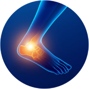 Ankle Supports