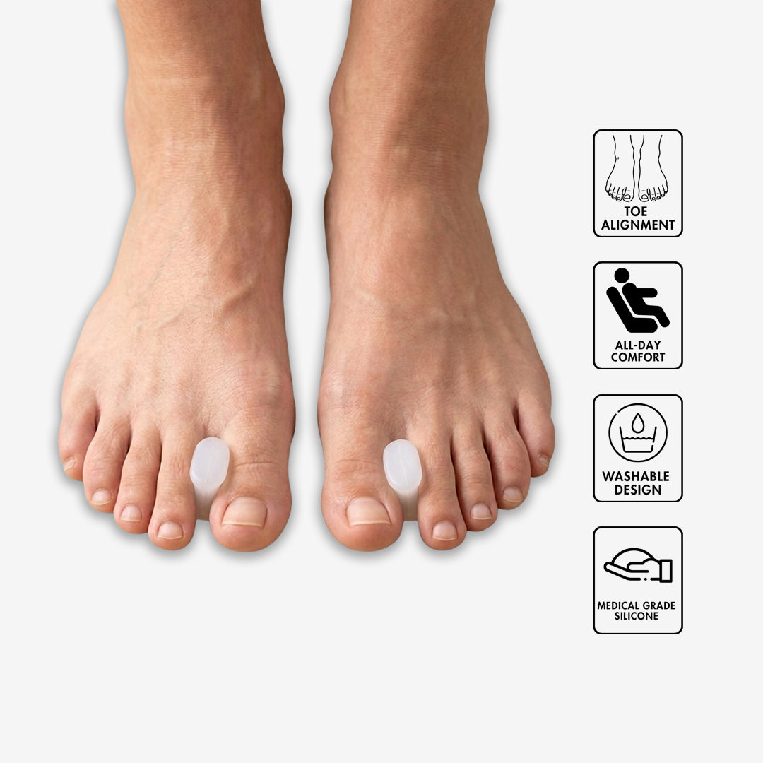 Toe Separators
