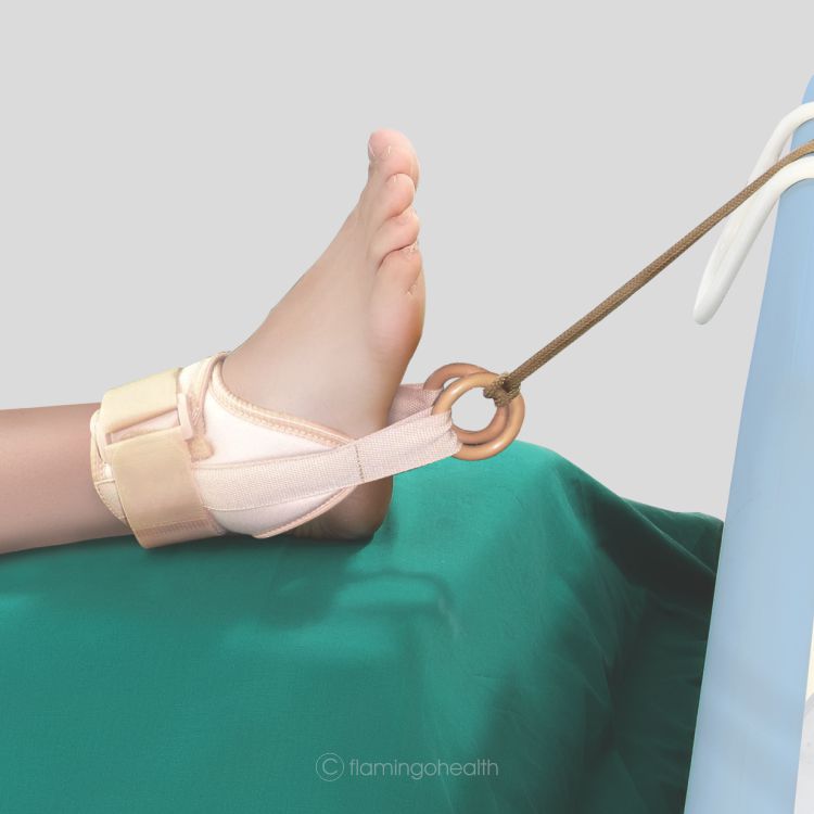 Ankle Traction Brace Flamingo Healthcare