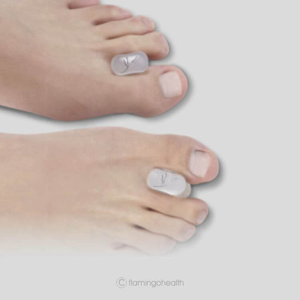 Premium Silicone Toe Separators (Pair)