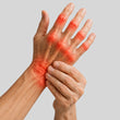 Arthritis