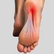 Plantar Fasciitis